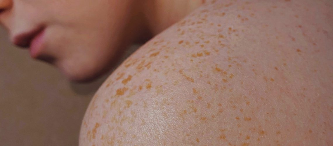 Skin facts